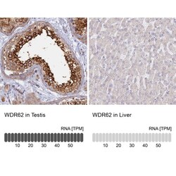 WDR62 Antibody, Novus Biologicals 25 &mu;L; Unlabeled:Antibodies, Polyclonal
